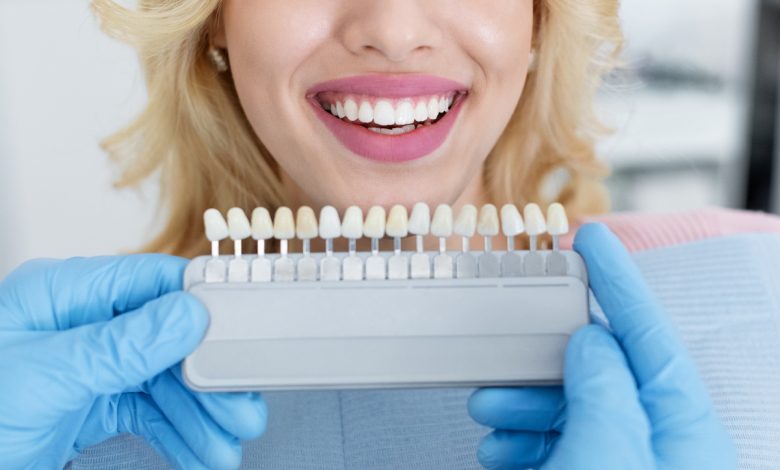 Делимся секретами белых зубов