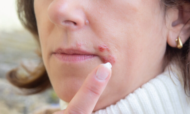 Половина жителей земли инфицирована.