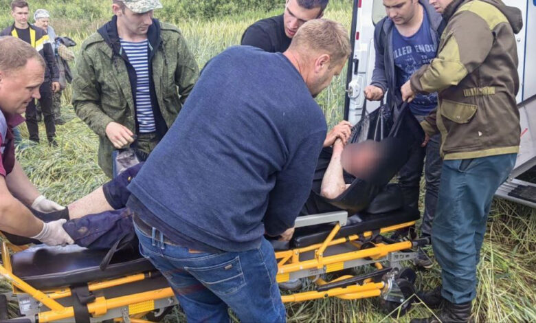 Под Гродно 7-летний ребенок попал с ожогами в реанимацию