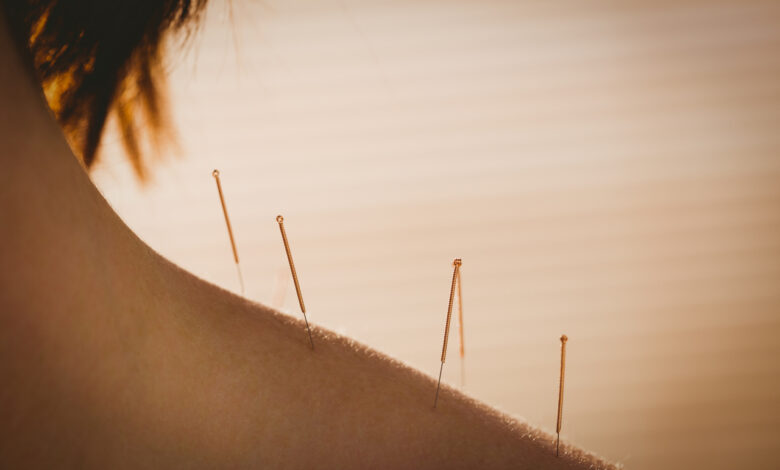 Домашнее иглоукалывание с иглами от шприца