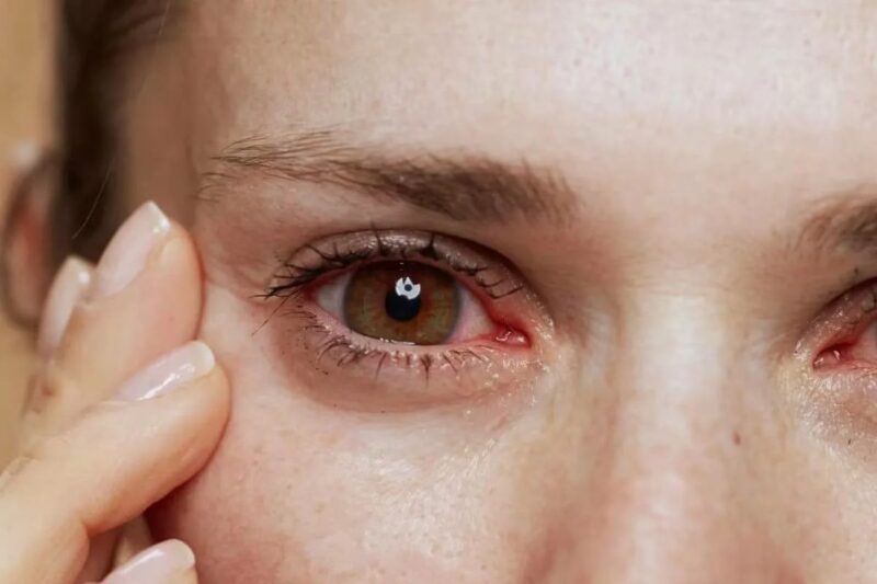 Как справиться с синдромом