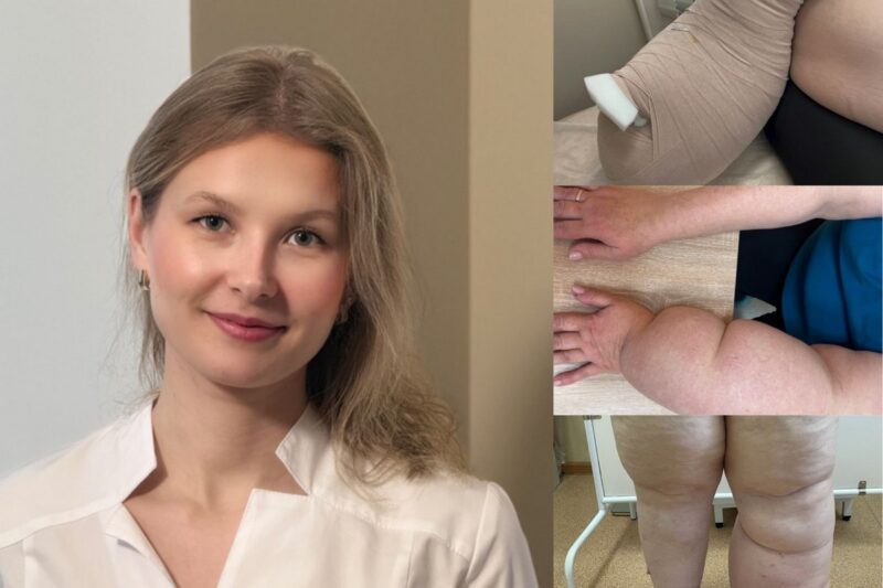 Почему появляется слоновость