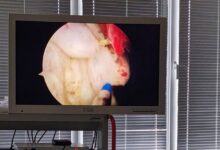 В Лидской ЦРБ появилось новое