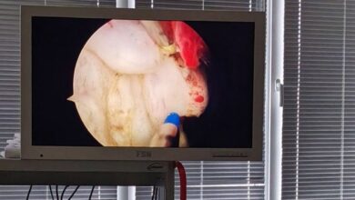 В Лидской ЦРБ появилось новое