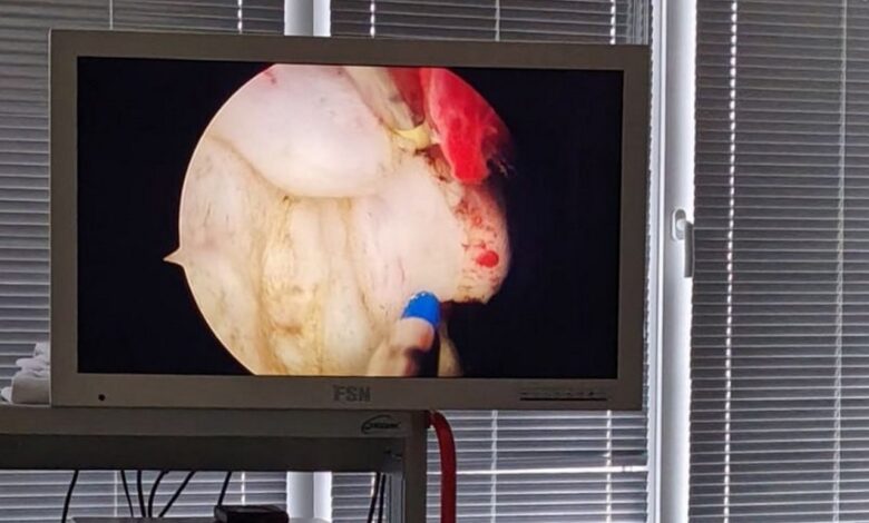 В Лидской ЦРБ появилось новое