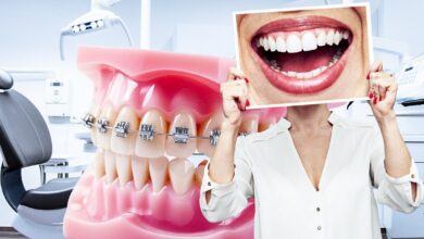 Семь лет в брекетах и без эффекта