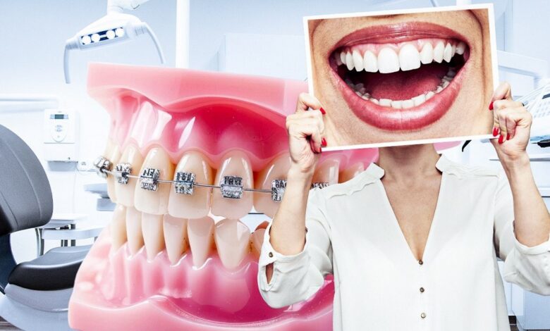 Семь лет в брекетах и без эффекта