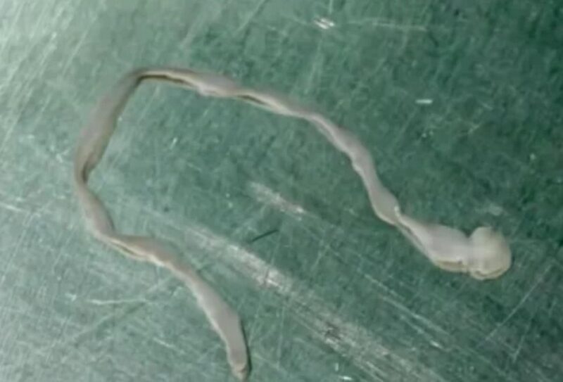 Причина странных симптомов: 